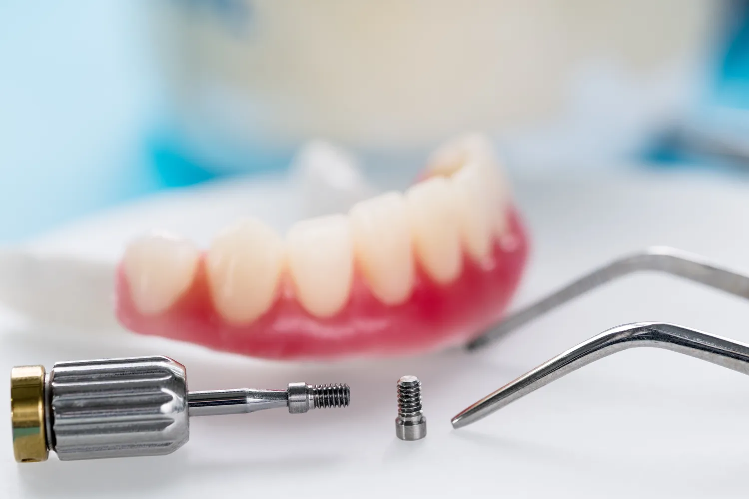 Dentysta Warszawa implanty