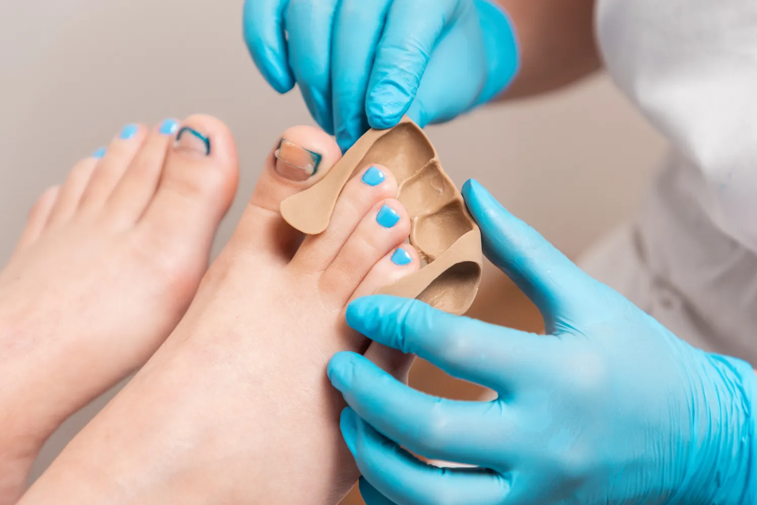  Pedicure leczniczy - co o nim wiedzieć warto?